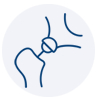 Complex Primary Total Hip Arthroplasty